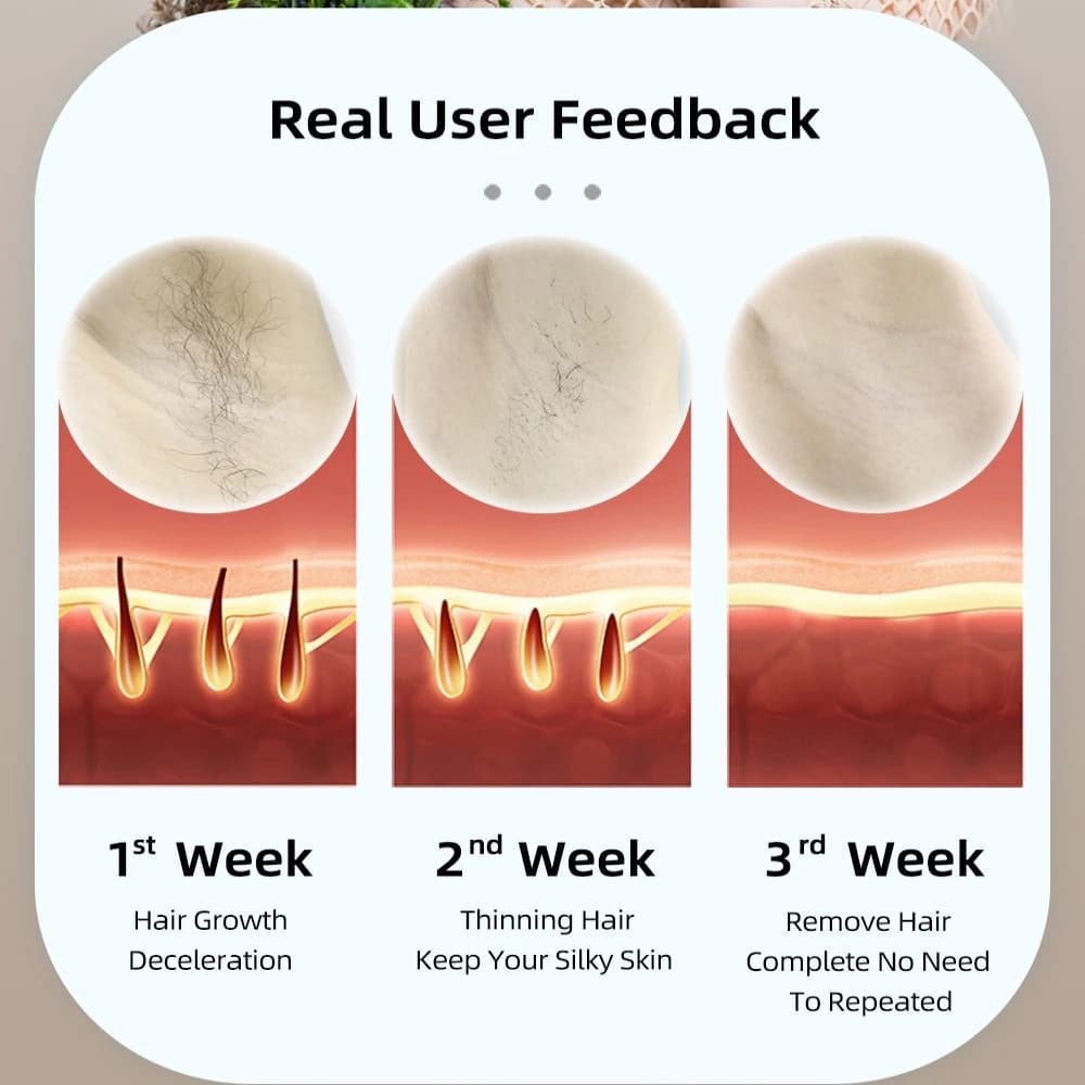 دروبشيبينغ جهاز إزالة الشعر بالليزر IPL للاستخدام المنزلي، علاج حب الشباب وتجديد البشرة - 5