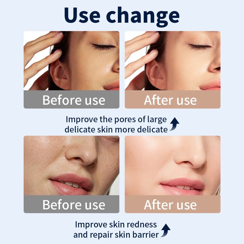 7 Color LED Face Mask with Neck Wireless Portable Red Light Therapy for Anti-Aging, Wrinkles, Skin Rejuvenation, Home Use - 5