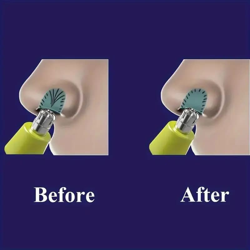 1 pcs Nose Hair Trimmer Replacement Heads Compatible for Philips One Blade & OneBlade Pro Shaver Waterproof Dual Edge Blades - 5