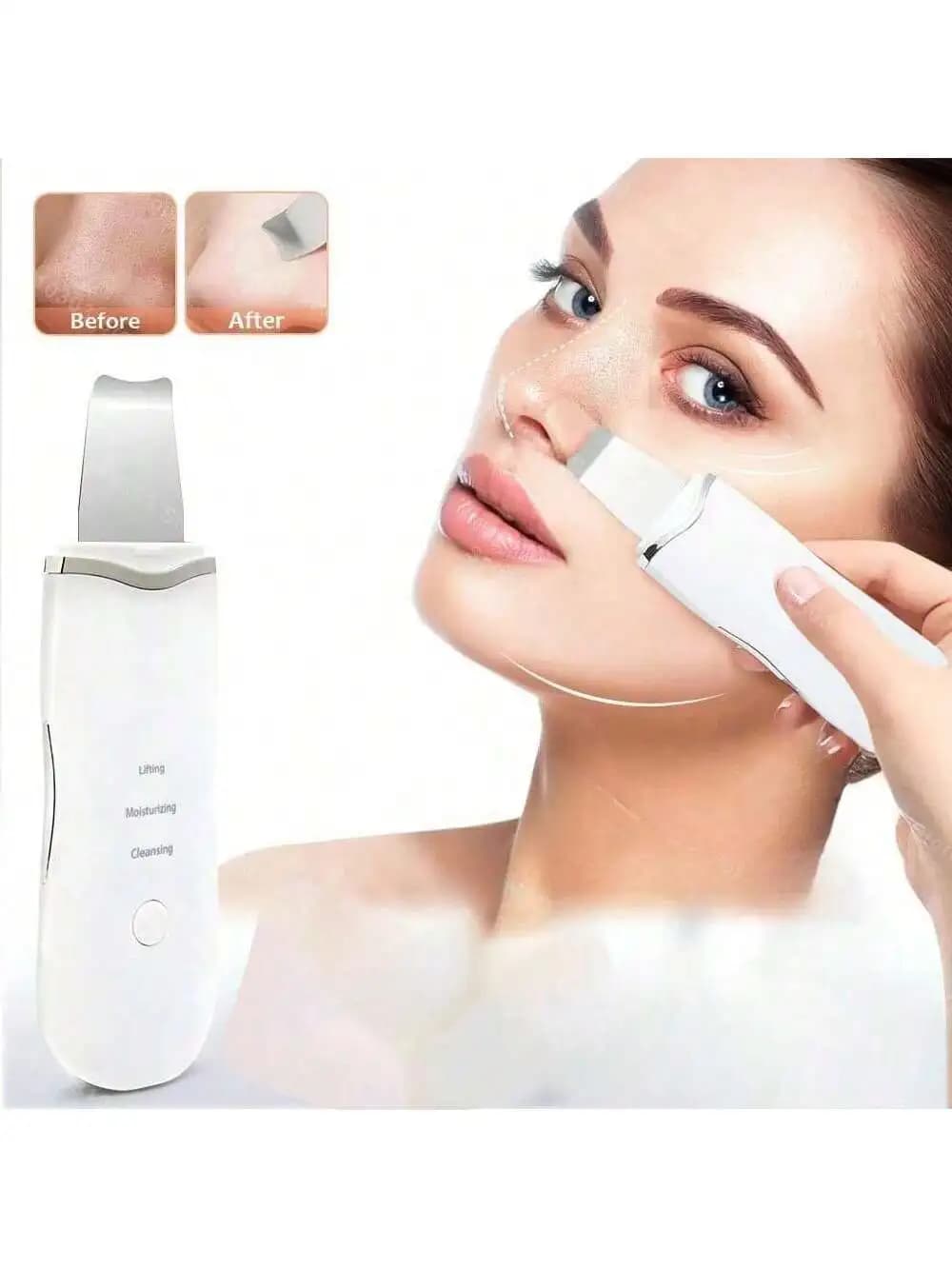 Ultrasonic Skin Scrubber Scrubber Deep Vibrate Facial Cleaner Shovel Face Scrubber Peeling Black Head Remover Facial Massager - 3