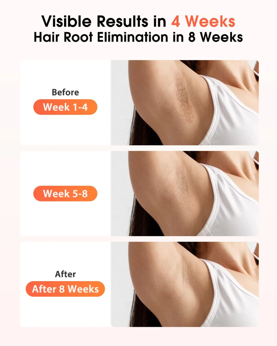 IPL Devices Hair Removal Laser 17J 999900 Light Pulses HR/SC/RA 9 Levels Whole Body Painless Hair Removal Home Use For Men Women - 3