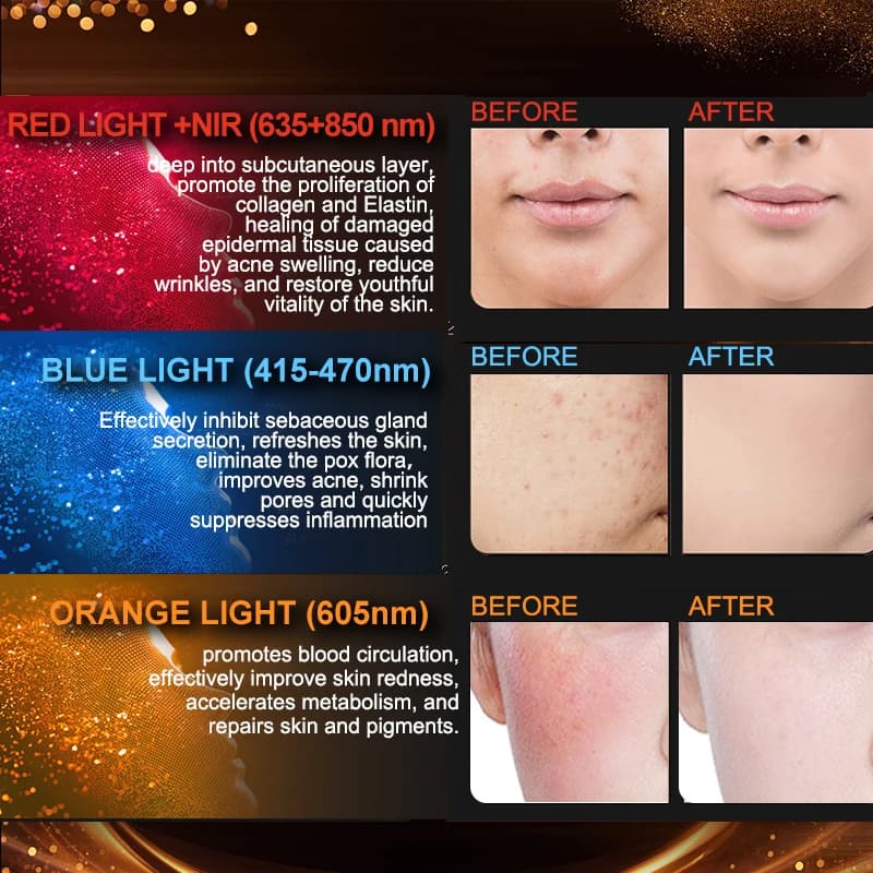 قناع الوجه LED بالأشعة تحت الحمراء NIR مع 170 مصباح، 3 ألوان، 3 مستويات سطوع، للعناية بالوجه والرقبة، جهاز العلاج بالضوء الأحمر للجمال - 2