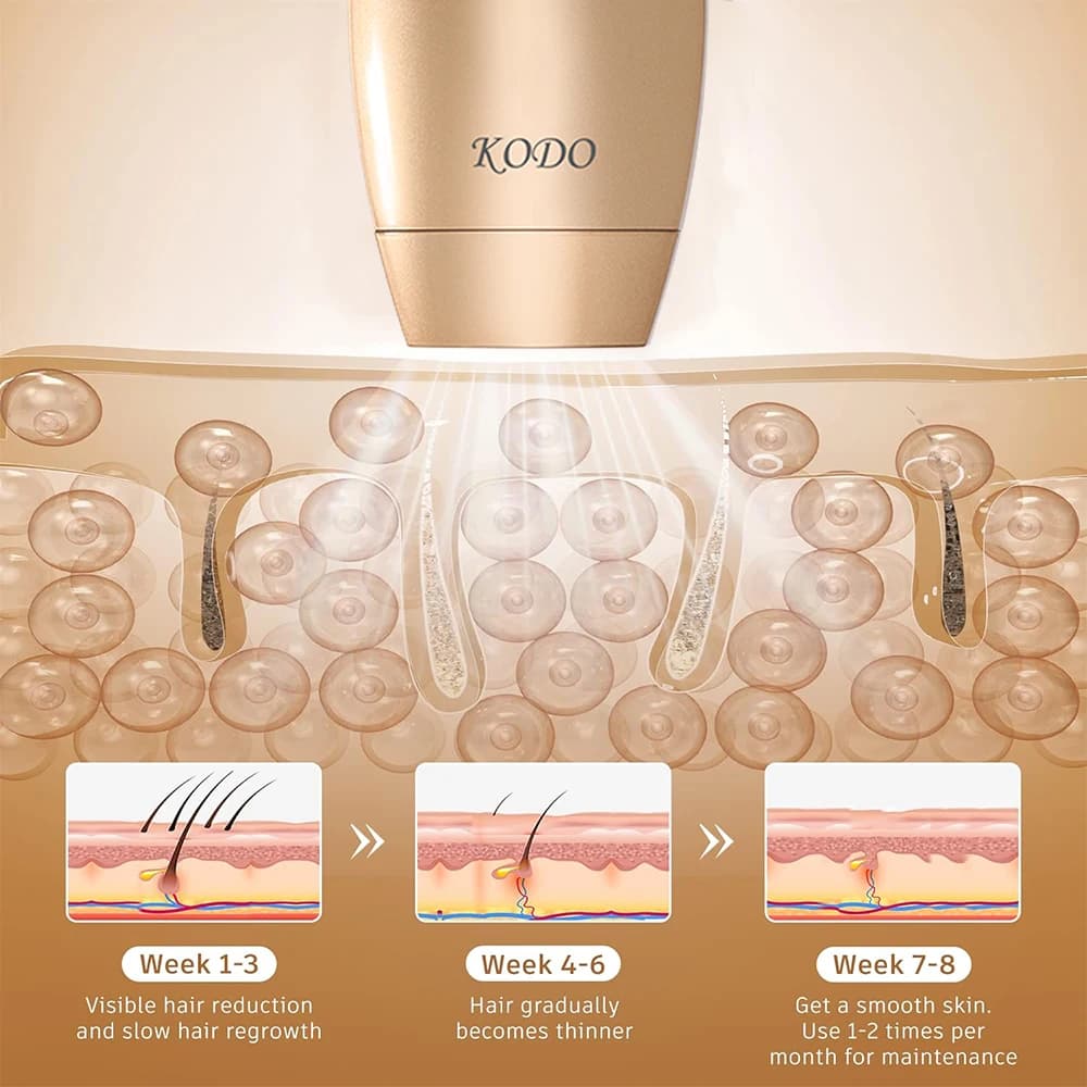 KODO 2026 High-end customization ice Laser Hair removal Laser Epilator Permanent IPL Painless Photoepilator 4 in 1 face and body - 6