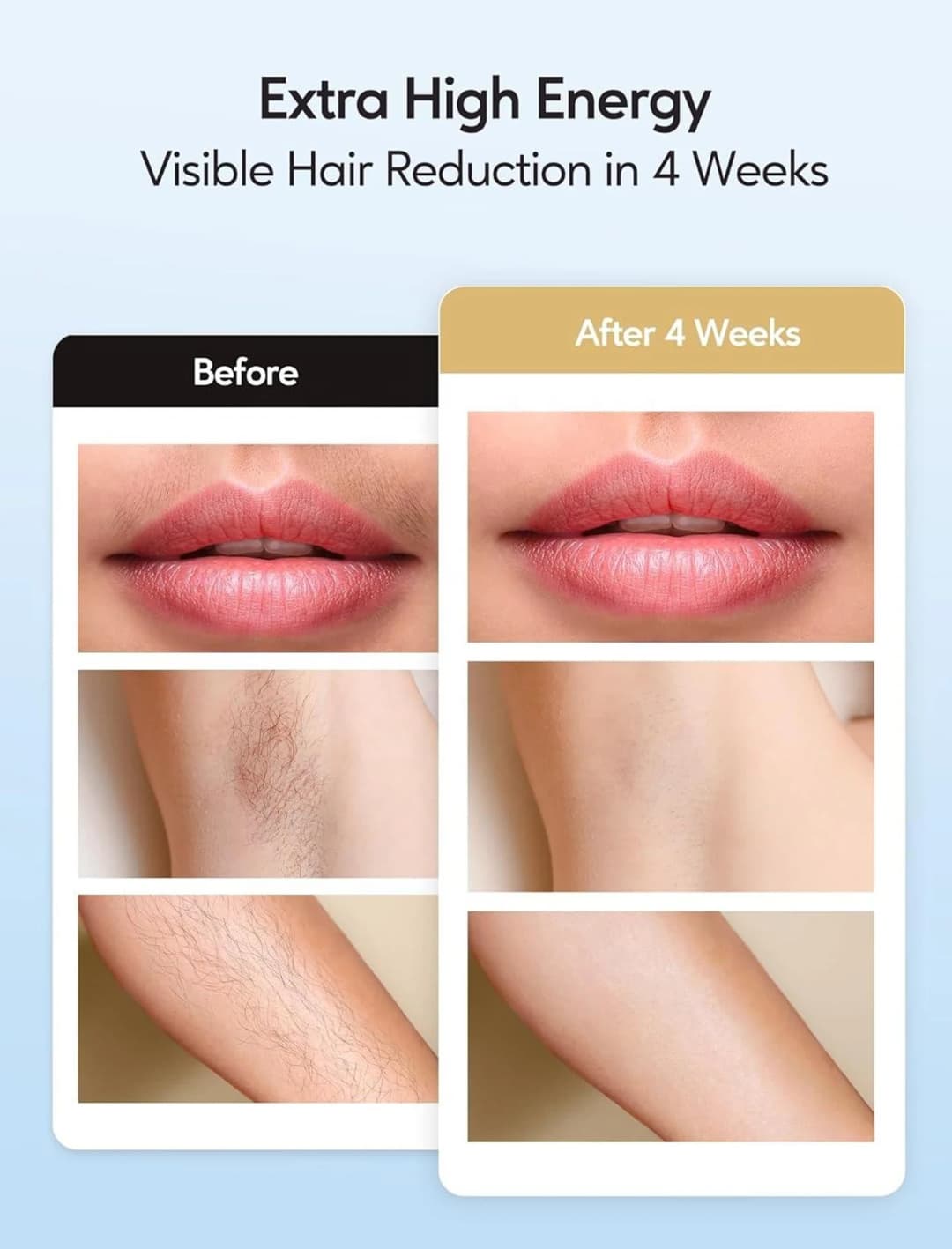 IPL Hair Removal with Ice Cooling Care Function for Women Permanent,999,999 Flashes Painless IPL Hair Remover Device - 4