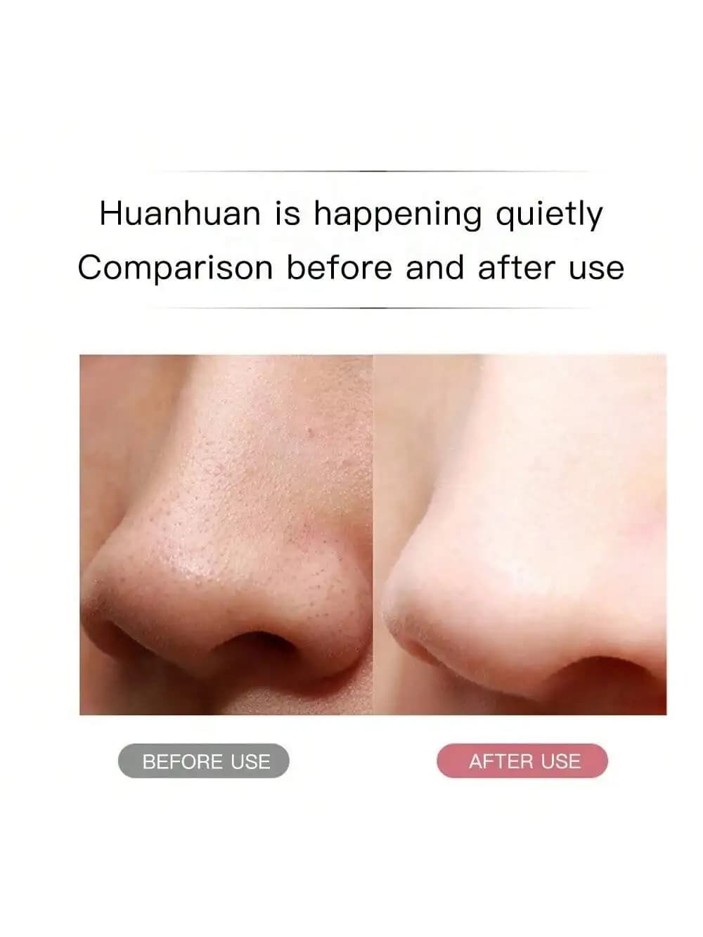 Ultrasonic Skin Scrubber Scrubber Deep Vibrate Facial Cleaner Shovel Face Scrubber Peeling Black Head Remover Facial Massager - 4