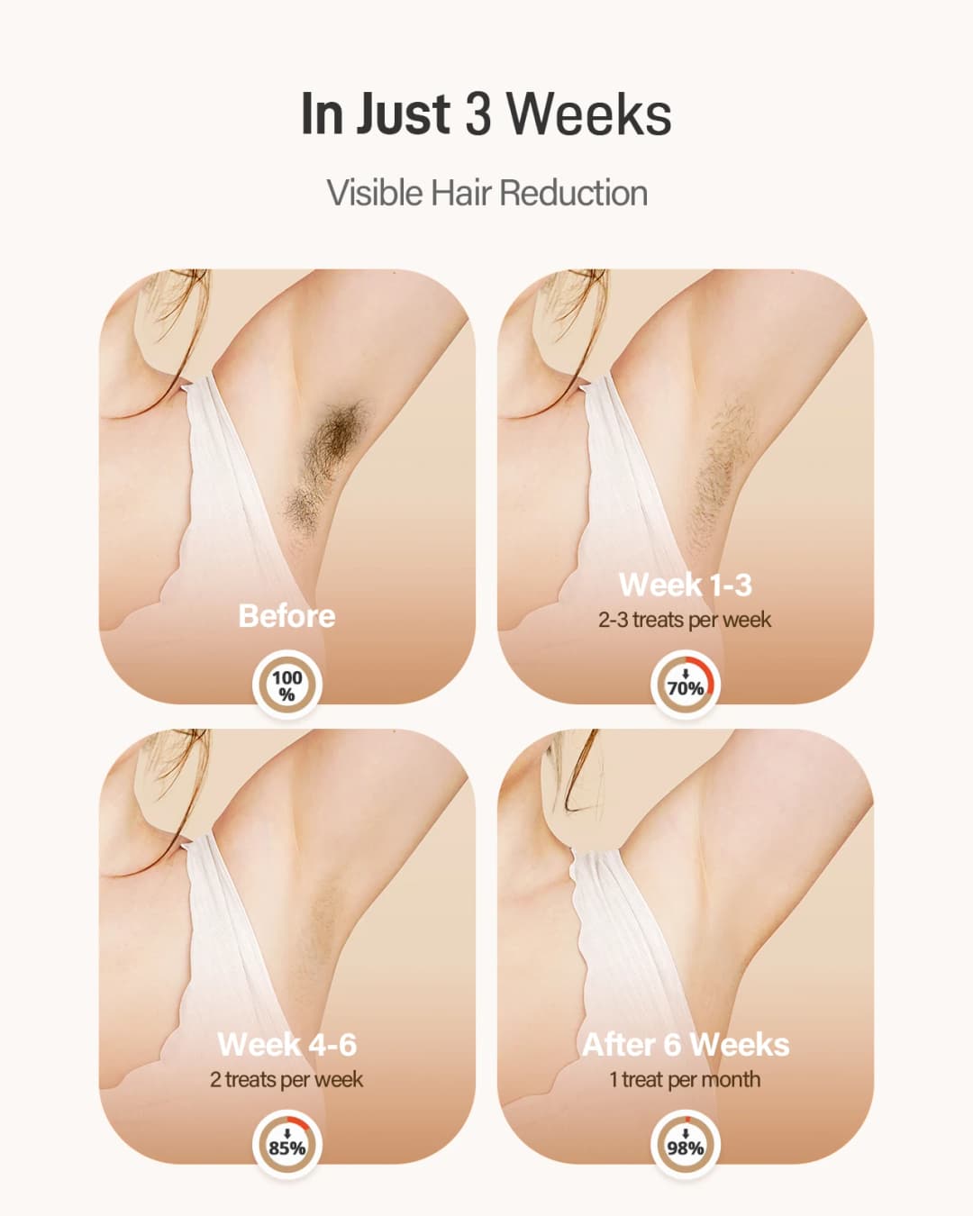 جهاز إزالة الشعر بالليزر للرجال والنساء ، ومضات IPL ، وضع مزدوج ، 3 أسابيع مرئية ، ليزر منزلي ، مزيل آمن سريع - 3