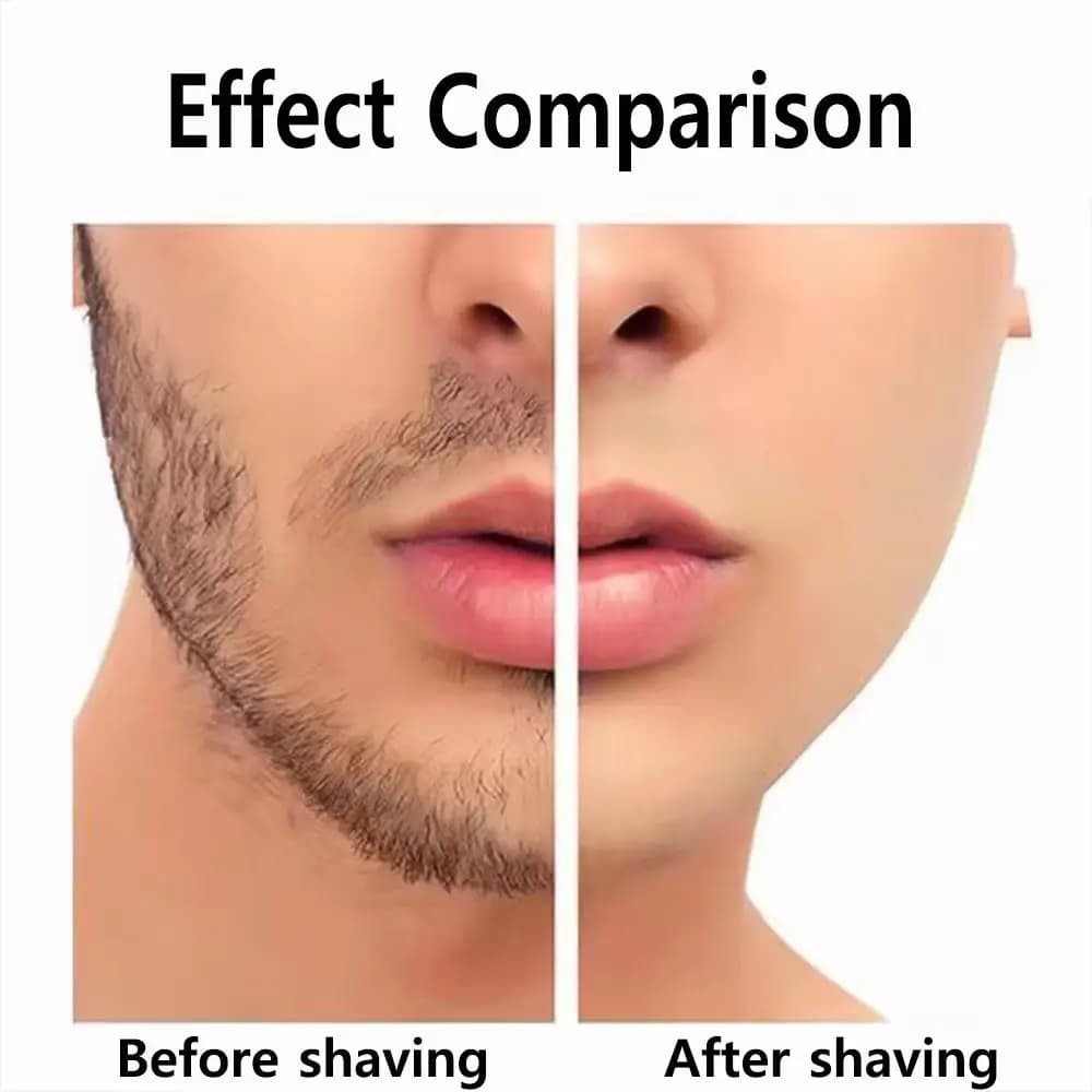 For Xiaomi Mijia S500C S500 S300 Electric Shaver Head Replace Shaver Head MJTXD01SKS Cutter Head Accessories - 5