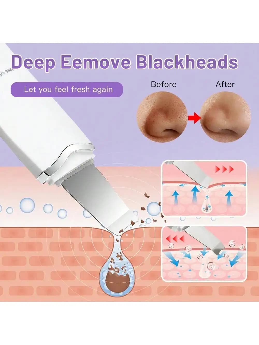 Ultrasonic Skin Scrubber Scrubber Deep Vibrate Facial Cleaner Shovel Face Scrubber Peeling Black Head Remover Facial Massager - 5