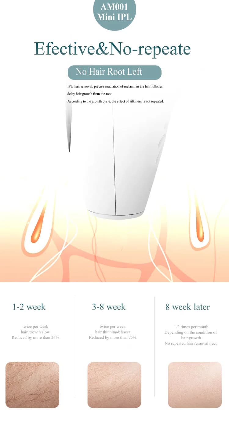 Professional Permanent Laser Depilator IPL Hair Removal For Whole Body, Depilator Remover Permanent Women Home Use Devices - 4